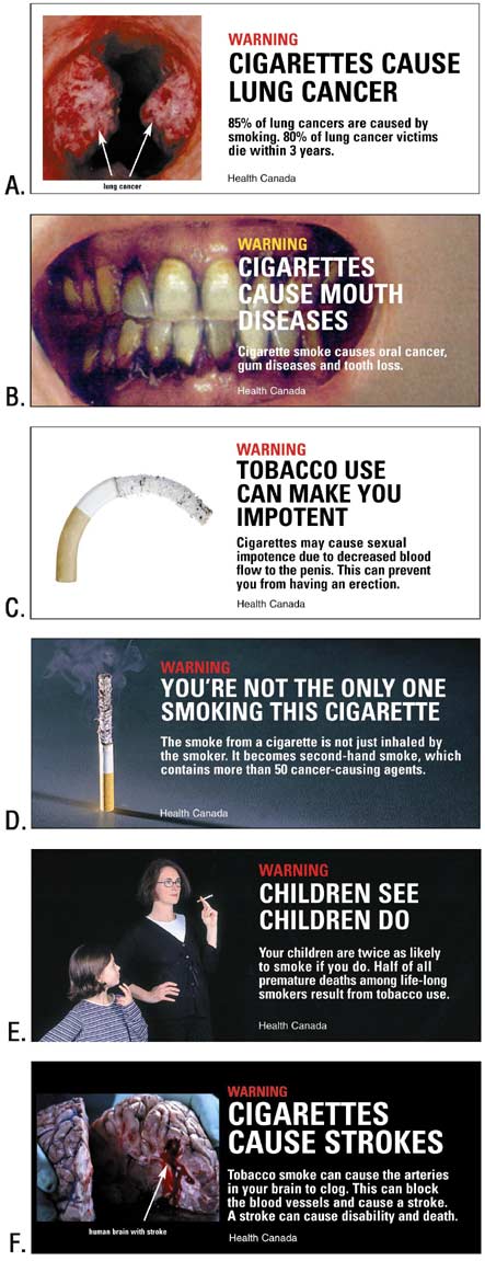 This is a series of six cigarette warning labels, A through F. Label A shows lungs with lung cancer and states, 揥arning: Cigarettes cause lung cancer.?Label B displays an open mouth with dental problems and gum disease and the text, 揥arning: Cigarettes cause mouth diseases.?Label C shows a curved, limp cigarette and the text, 揥arning: Tobacco use can make you impotent.?Label D shows a burning cigarette standing on end with a caption about secondhand smoke that states, 揥arning: You抮e not the only one smoking this cigarette.?Label E shows a mother with a female child approximately aged 8 years with the text, 揥arning: Children see, children do? Label F displays a picture of a human brain following a stroke and the statement, 揥arning: Cigarettes cause strokes.? width=