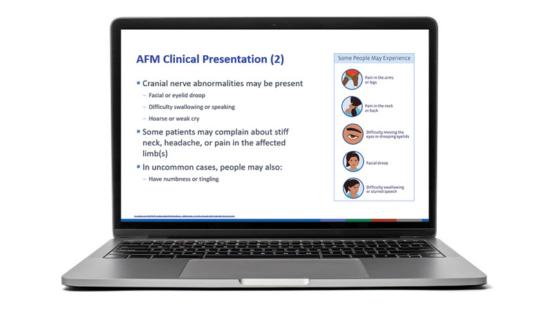hcp-slides laptop with a slide from CDC's AFM presentation