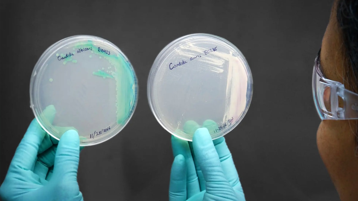 candida-auris-lab-1200 A lab scientist hold two closed petri dishes with strains of candida auris