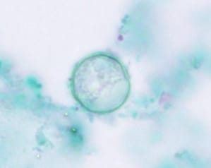 Cyclospora_trichrome_HB2_s Micrograph showing circular oocysts of the parasite C. cayetanensis