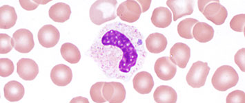 Figure 1: Morulae detected in a granulocyte on a peripheral blood smear, associated with <em>A. phagocytophilum</em> infection. blood smear