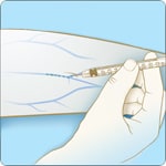 An illustration showing a needle inserted into the skin and anthrax spores traveling in the bloodstream.
