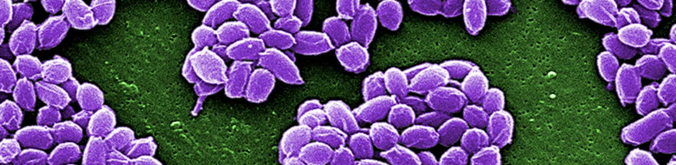 Under high magnification this SEM image depicted endospores from the Sterne strain of Bacillus anthracis bacteria.