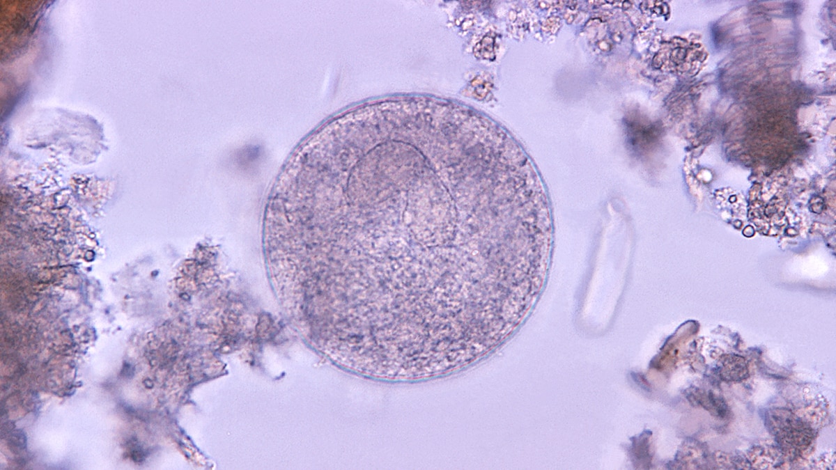 balantidium coli Balantidium coli parasitic cyst