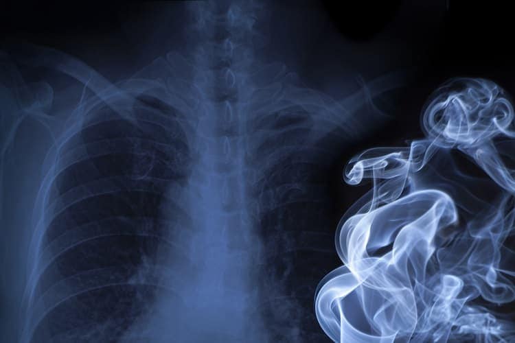 Foto del humo del cigarrillo