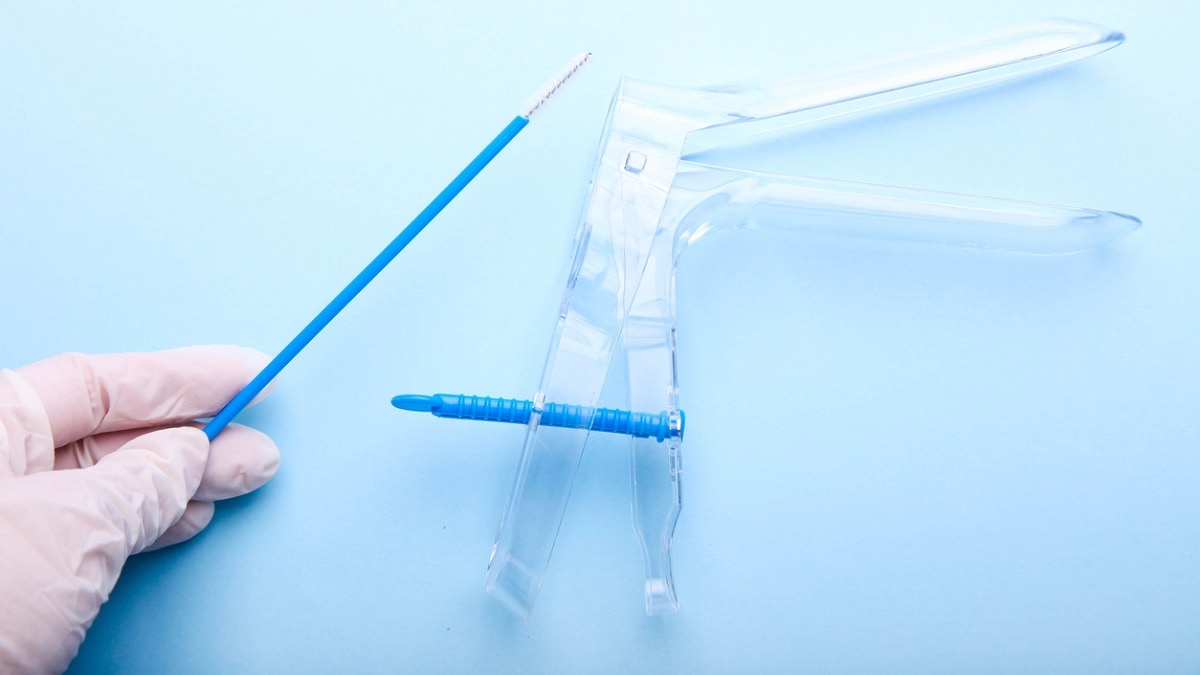 Speculum Cytology Brush A cytology brush and a speculum.