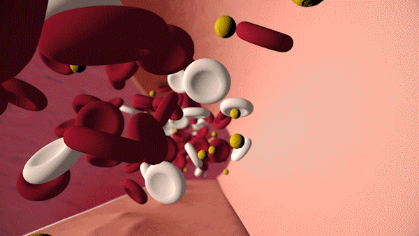 Cholesterol-Monster Red blood cells, white blood cells, and low-density lipoprotein (or blood cholesterol) flowing through an artery. Arterial plaque from high blood cholesterol builds up slowly, causing the artery wall to narrow. The image reads: Is "bad" cholesterol building up in your arteries? Find out with a simple blood test. Talk to a health care professional about cholesterol screening.
