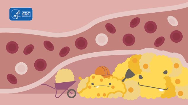 Cholesterol-Monster3 Three cholesterol monsters.
