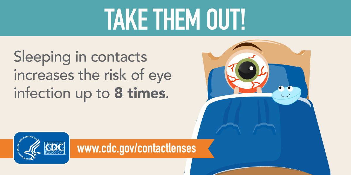 CLHW-button-TakeOut-Twitter-tn2 Take them out! Sleeping in contacts increases the risk of eye infection up to 8 times.