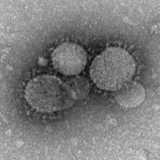 Novel coronavirus particles as seen by negative stain electron microscopy. Virions contain characteristic club-like projections emanating from the viral membrane.