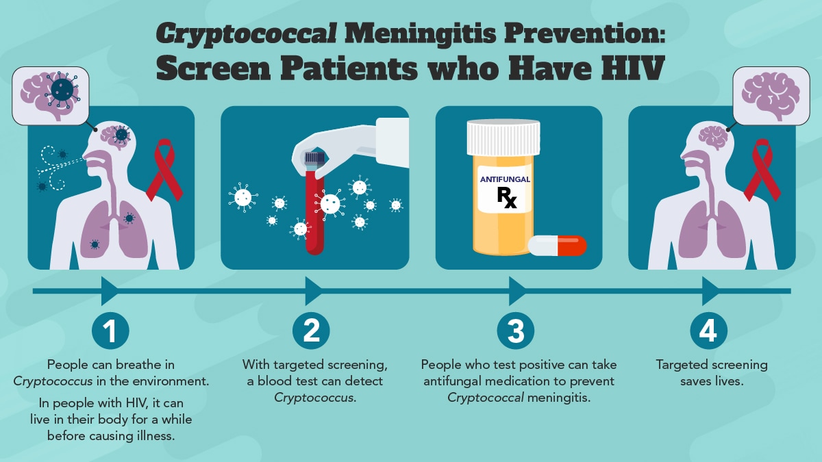 A 4 panel graphic illustration. A silhouette of a person with the red ribbon symbolizing HIV, breathes in Cryptococcus. A laboratory scientists hand holding a blood vial to demonstrate that the blood is tested for cryptococcal antigens. The third graphic panel shows prescription antifungals. In the last graphic the silloutte is seen again and the patient's brain is shown without cryptococcus spores.