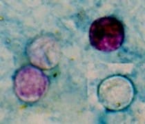 cyclospora-cayetanensis
