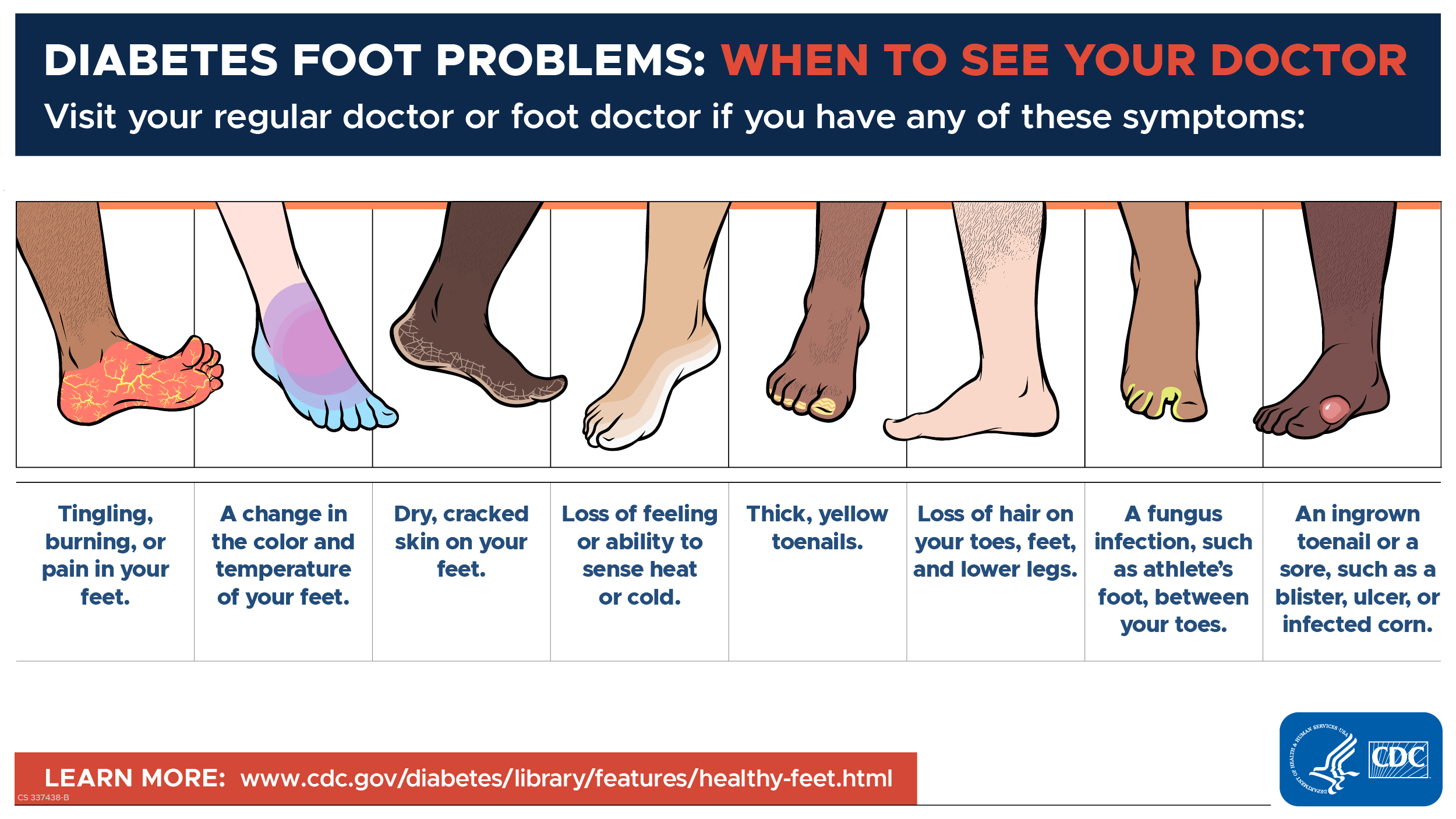 337438-B_FOOT_SYMPTOMS_1200x675_FINAL_3.24 Diabetes Foot Problems: When to See Your Doctor
