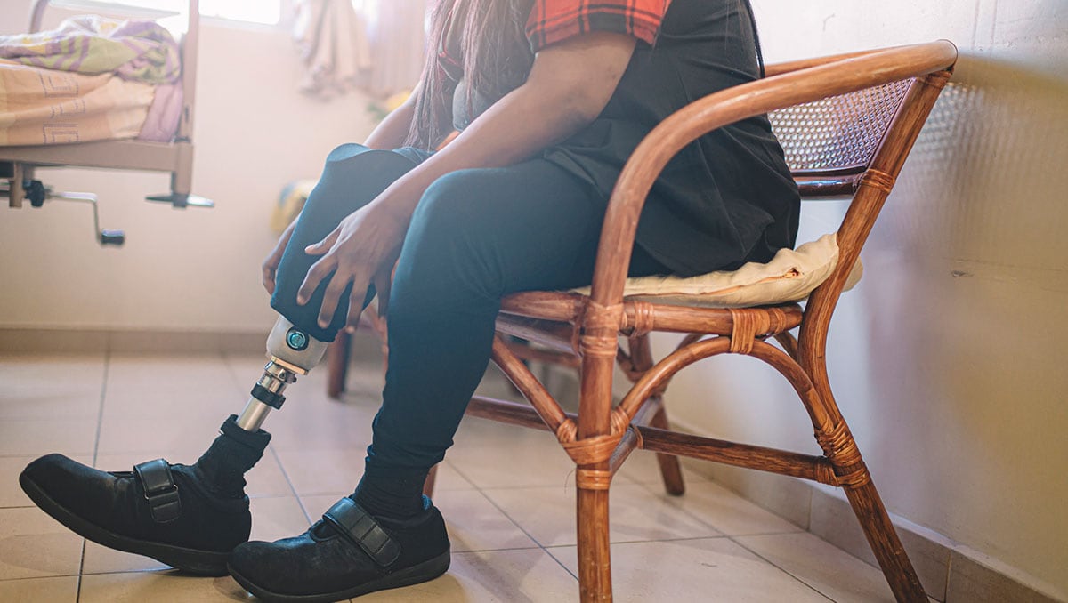 An Asian Indian person with prosthetic leg adjusting her artificial limb at hospital ward African American woman’s feet with pink nail polish