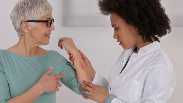 Sensitive Skin, Food allergy symptoms, Irritation. Doctor dermatology and patient An older woman with a rash on her arm is examined by a dermatologist.