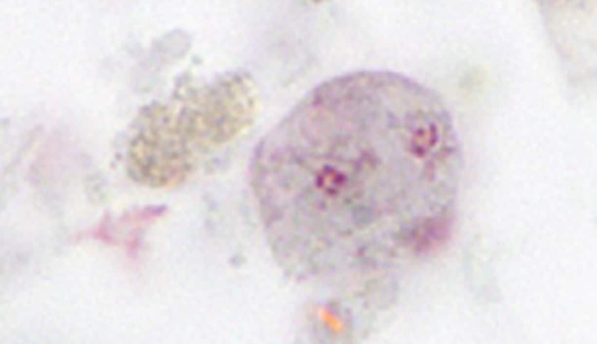 — title missing — Dientamoeba fragilis