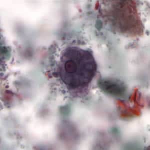 Ehistdisp_cyst_tric4.jpg Figure B: Cyst of <em>E. histolytica/E. dispar</em> stained with trichrome.