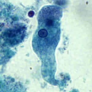 Ehistdisp_troph_tric.jpg Figure A: Trophozoite of <em>E. histolytica/E. dispar</em> stained with trichrome.