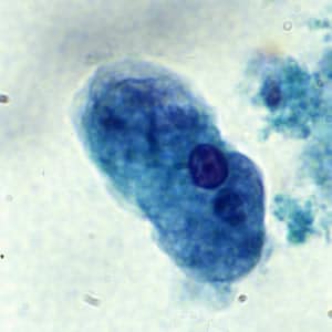 Ehistdisp_troph_tric2.jpg Figure B: Trophozoite of <em>E. histolytica/E. dispar</em> stained with trichrome.