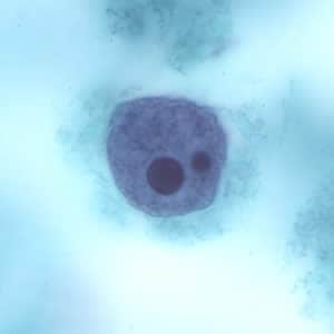 Ehisto_troph_tric6.jpg Figure D: Trophozoite of <em>E. histolytica</em> with ingested erythrocytes stained with trichrome.