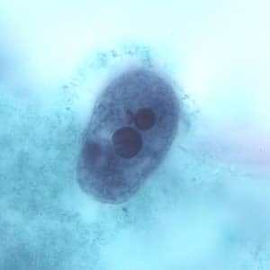 Ehisto_troph_tric7.jpg Figure E: Trophozoite of <em>E. histolytica</em> ingested erythrocytes stained with trichrome.