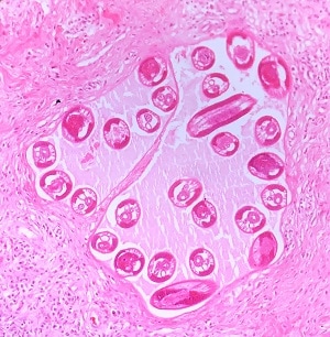 2C Figure C