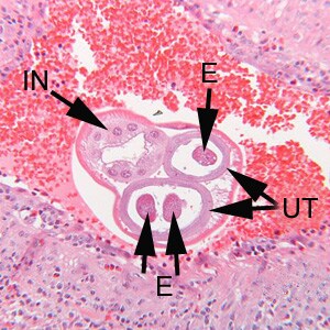 A_costaricensis_MN_B.jpg Figure B: Higher magnification of the specimen in Figure A. Notice the thick, multinucleate intestine (IN) and eggs (EG) within the uterus (UT).