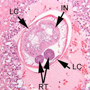 A_costaricensis_MN_D.jpg Figure D: Higher magnification of the specimen in Figure C. Shown here are the thick, multinucleate intestine (IN), reproductive tubes (RT), and lateral chords (LC).