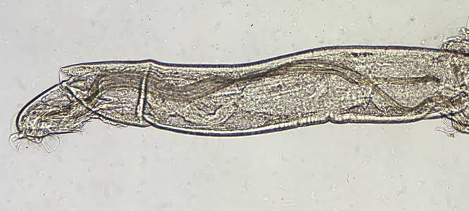 Angio_10x_spicules_web.jpg Figure C: Higher magnification of the worm in Figure B.