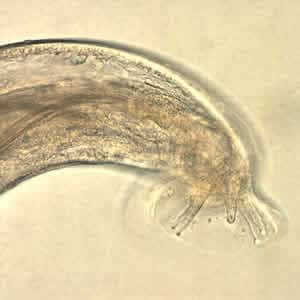 Angio_40x_bursa4_web.jpg Figure E: Same specimen as in Figure D but in a different focal plane.