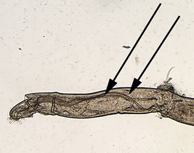 Angio_4x_spicules_annot_web.jpg Figure B: <em>Angiostrongylus</em> worm. Note the very long spicules (black arrows), one of the indications that this is a male worm.