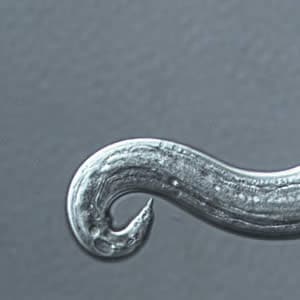 Acantonensis_tail_zoom.jpg Figure C: Higher magnification of Image B. Note the terminal projection on the tip of the tail which is characteristic of <em>A. cantonensis</em>.