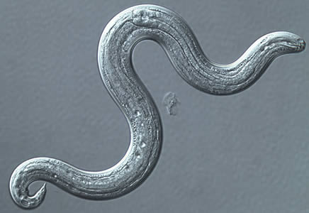Angio3_dic_400x.jpg Figure B: <em>A. cantonensis</em> (L3), infective larvae recovered from a slug. Image captured under DIC microscopy.