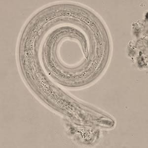 HI_slug5_tail_400x.jpg Figure C: <em>A. cantonensis</em> L3 infective larva in wet mount, recovered from slug tissue