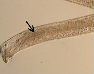 L5_spicule1 Figure B