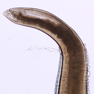 Figure F: Posterior end of <em>Pseudoterranova</em> sp. Image taken at 200x magnification.