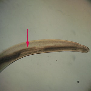 Figure C: Anterior end of <em>Pseudoterranova</em> sp. The red arrow indicates the intestinal cecum.