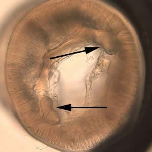 Figure A: Cross-section of <em>Pseudoterranova</em> sp. Note the large butterfly-shaped lateral chords (black arrows), characteristic for this genus.