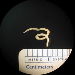 Figure A: L3 larva of <em>Pseudoterranova</em> sp. Ten units = one centimeter.