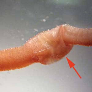 Figure B: Earthworms (<em>Lumbricus</em> and related) are commonly sent to the public health laboratories for identification. The presence of setae, segmentation, and a clitellum (red arrow) should distinguish them from parasitic helminths. Images courtesy of the Kentucky Department of Health.