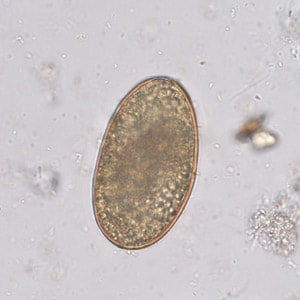 A_lumbricoides_infert_Leiden_A.jpg Figure E: Infertile, decorticated egg of <em>Ascaris lumbricoides</em>. Image courtesy of The Leiden University Medical Center, The Netherlands.