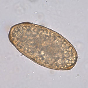 A_lumbricoides_infert_Leiden_B.jpg Figure F: Infertile, decorticated egg of <em>Ascaris lumbricoides</em>. Image courtesy of The Leiden University Medical Center, The Netherlands.
