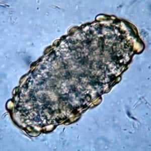 Ascaris_egg_unfert.jpg Figure A: Unfertilized egg of <em>A. lumbricoides</em>. Note the prominent mammillations on the outer layer.