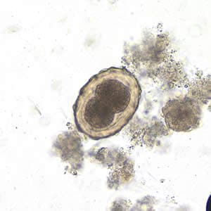 Ascaris_egg_fert3_embryo_200x.jpg Figure C: Fertilized egg of <em>A. lumbricoides</em> in an unstained wet mount of stool, undergoing early stages of cleavage. Image taken at 200x magnification.