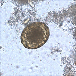 Ascaris_fertile_BAM1.jpg Figure D: Fertilized egg of <em>A. lumbricoides</em> in an unstained wet mount of stool.