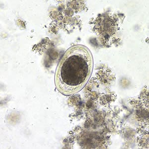 Ascaris_egg_fert2_decort_200x.jpg Figure B: <em>A. lumbricoides</em> decorticated, fertile egg in wet mounts, 200x magnification.
