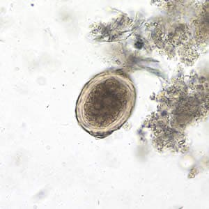 Ascaris_egg_fert3_decort_200x.jpg Figure C: <em>A. lumbricoides</em> decorticated, fertile egg in a wet mount, 200x magnification. The embryo has advanced cleavage.