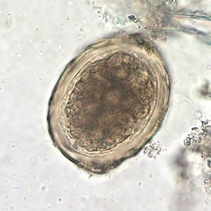 Ascaris_egg_fert4_decort_400x.jpg Figure D: The same egg as in Figure C, but at 400x magnification.