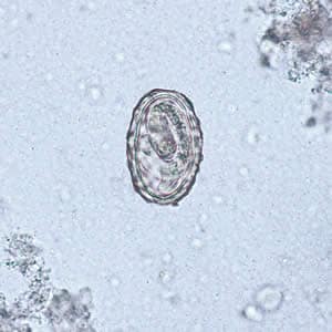 Ascaris_egg_larva2.jpg Figure A: Larva of <em>A. lumbricoides</em> hatching from an egg.