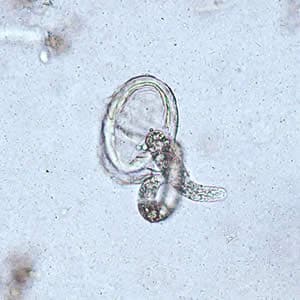 Ascaris_egg_larva3.jpg Figure B: Larva of <em>A. lumbricoides</em> hatching from an egg.